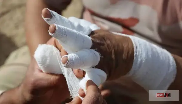 التحقيقات تكشف محاولة عامل إنهاء حياته بإشعال النيران في نفسه بالمنيا